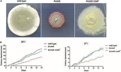 Calcineurin A Is Essential in the Regulation of Asexual Development, Stress Responses and Pathogenesis in Talaromyces marneffei